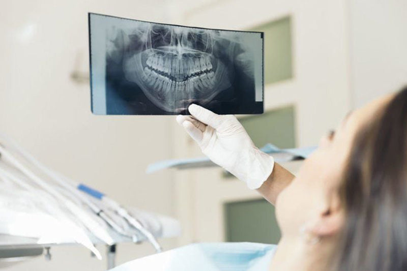 How to Choose Zirconia Blocks for CAD/CAM Dental Labs